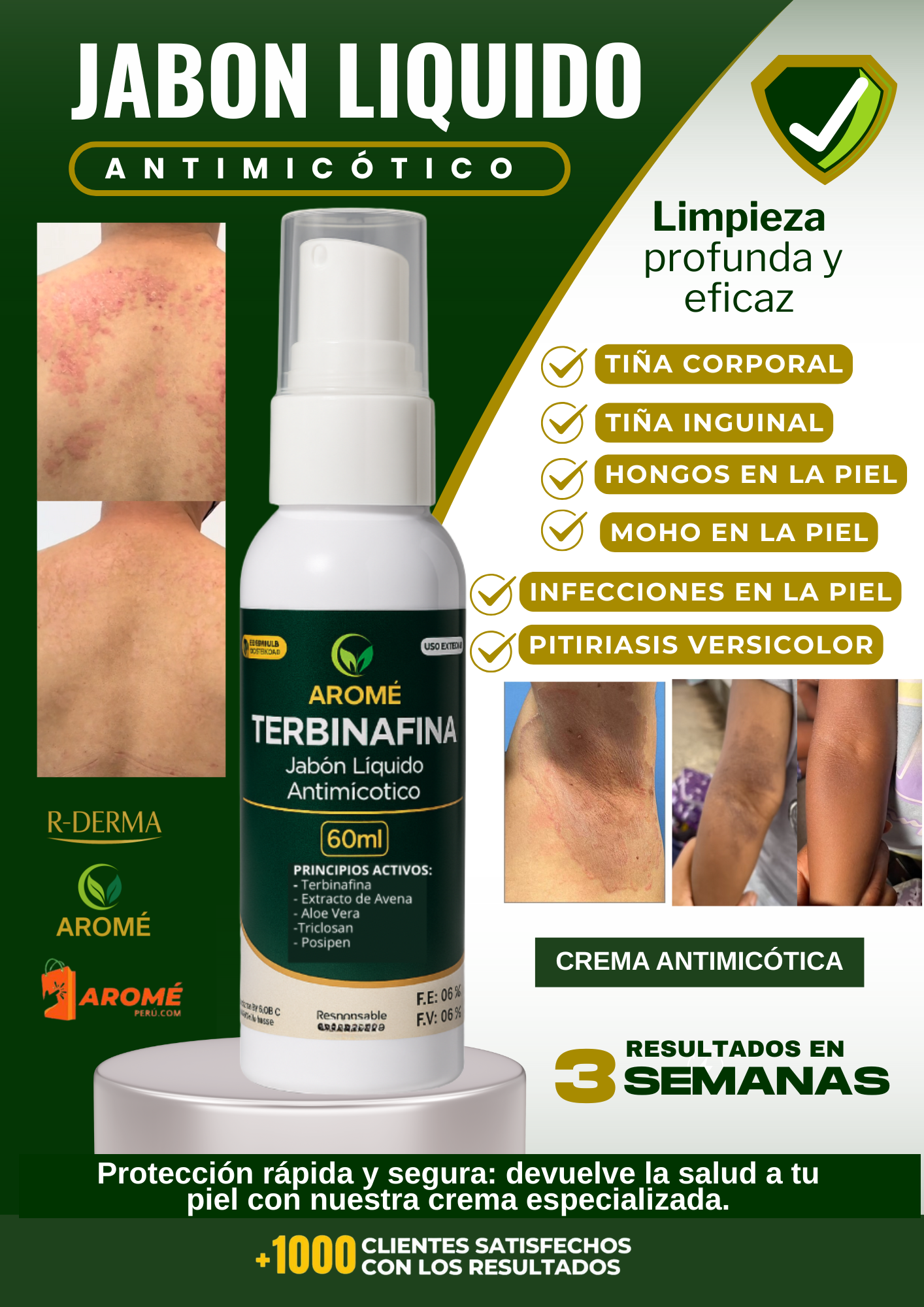 JABON LIQUIDO ANTIMICÓTICO - (Protege y purifica tu piel desde la raíz)