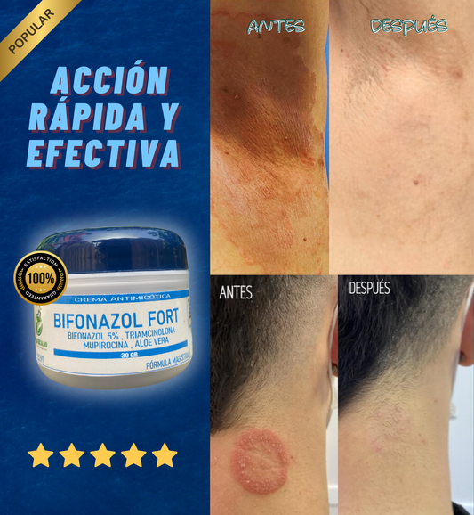 BIFONAZOL FORT ELIMINA LAS INFECCIONES EN LA PIEL (Elimina tiñas e infecciones por hongos)