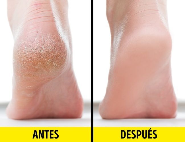 JABÓN LÍQUIDO ANTIMICÓTICO (ELIMINA LOS HONGOS DE RAIZ)